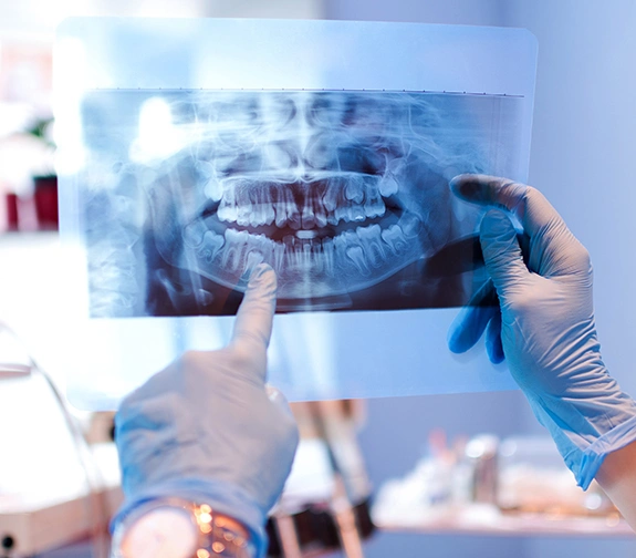 Digital X-rays St. Charles IL