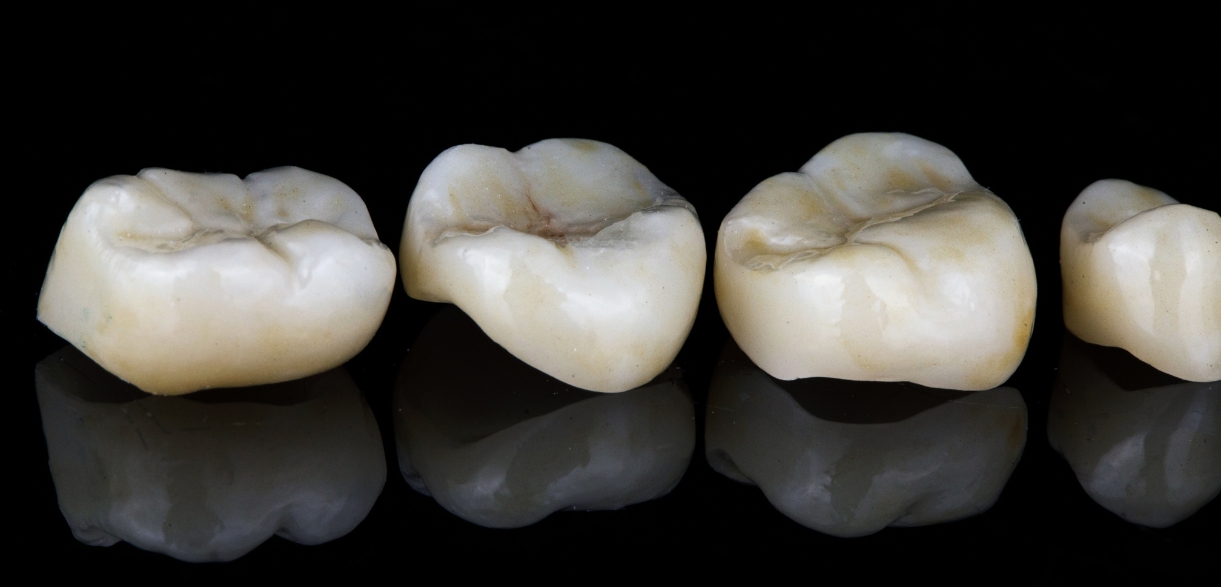 prioritize dental cleanings