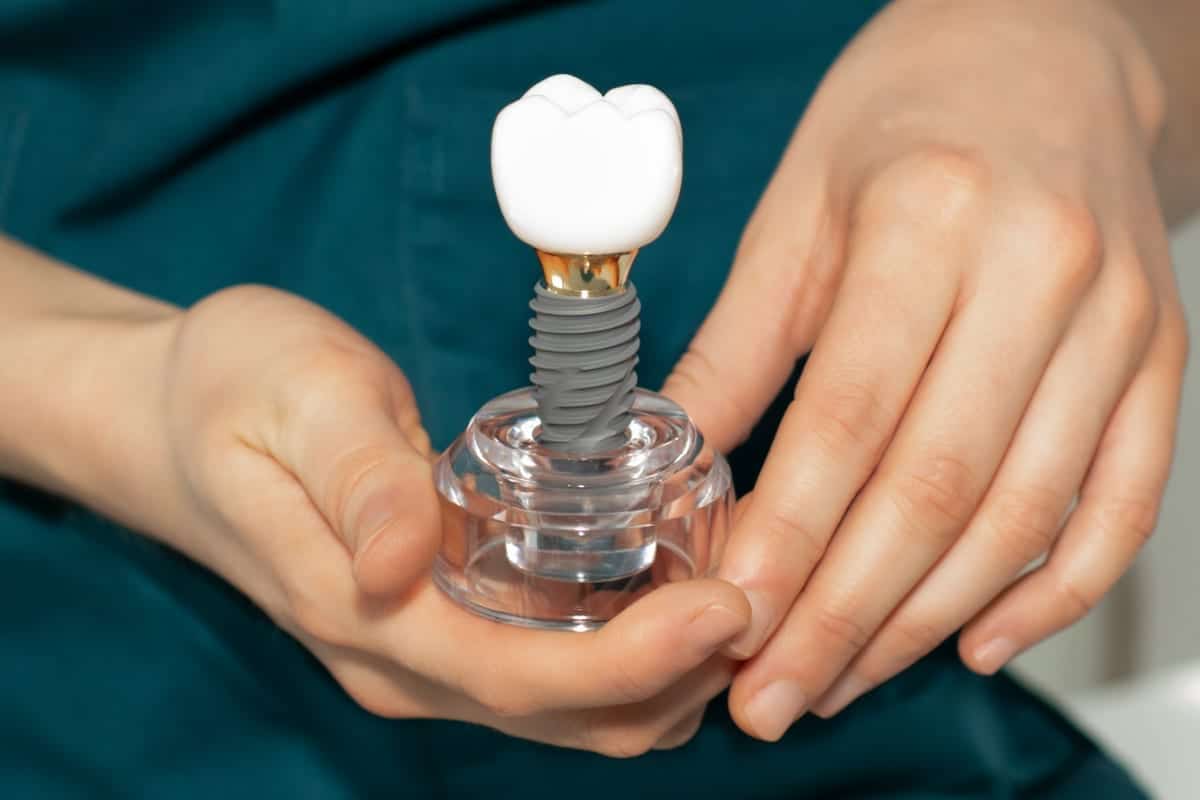 Dental Implants in Farmington