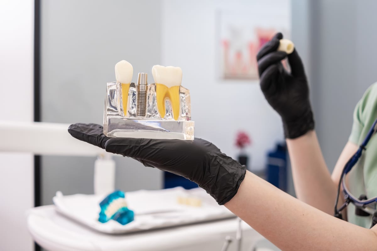 Dental Crowns in St. Charles